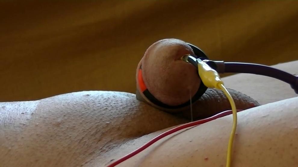 Electro Estim Deepinside2 Fromprostate2cock Short Porn Videos